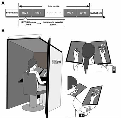 A Case Series Clinical Trial of a Novel Approach Using Augmented Reality That Inspires Self-body Cognition in Patients With Stroke: Effects on Motor Function and Resting-State Brain Functional Connectivity